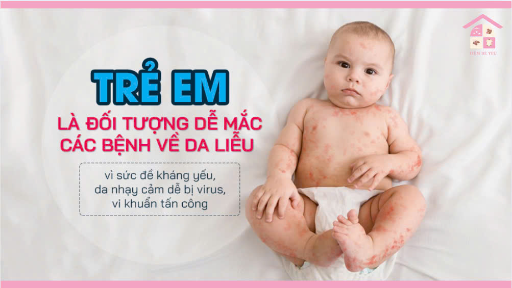 6 vấn đề về da của bé và cách phòng chống